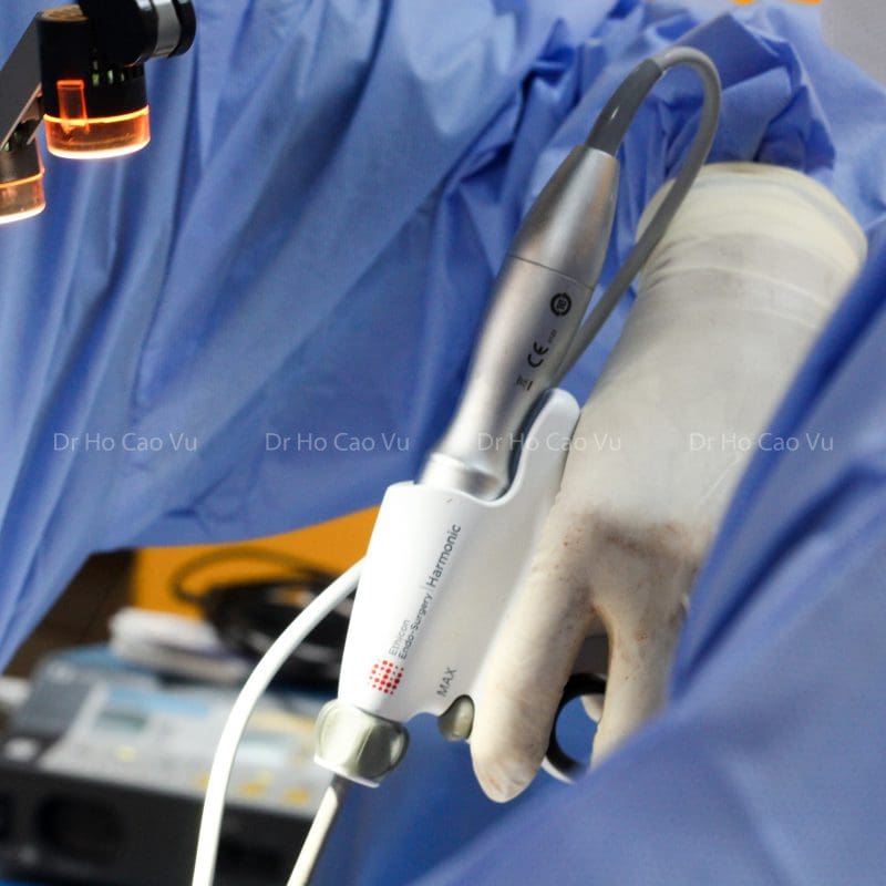breast-augmentation-using-Harmonic-Scalpel