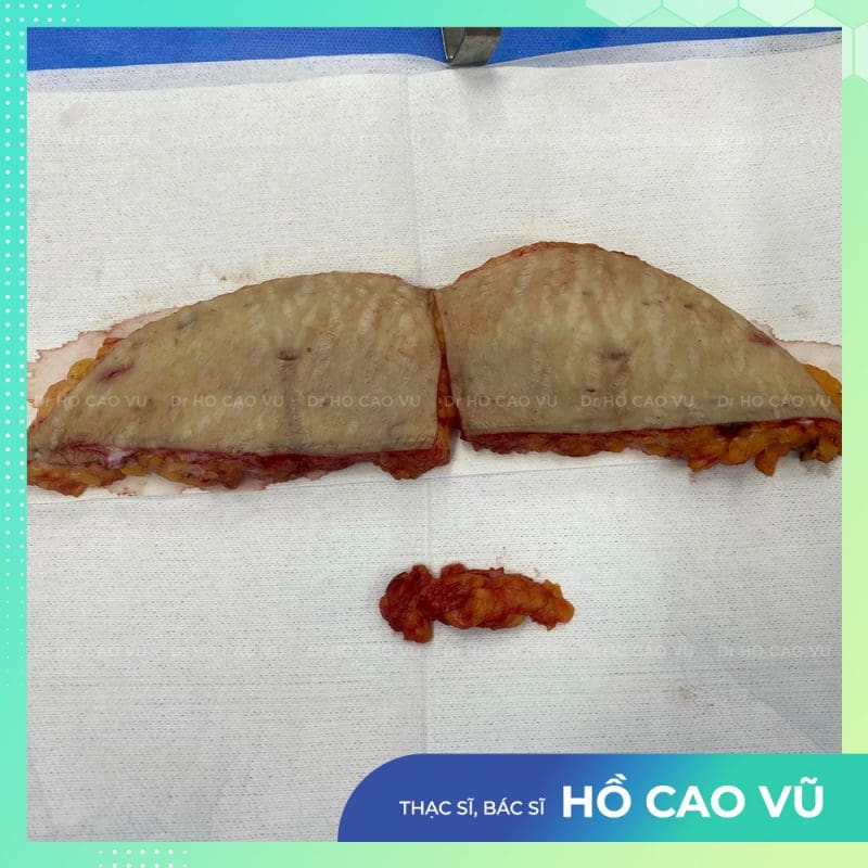 tao-hinh-thanh-bung-5