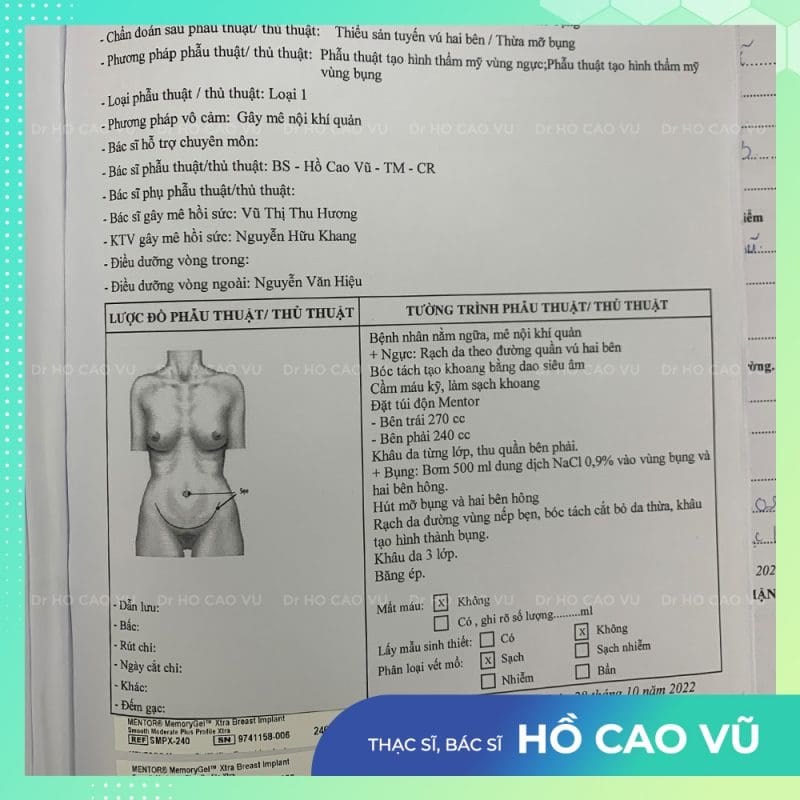 tao-hinh-thanh-bung-24