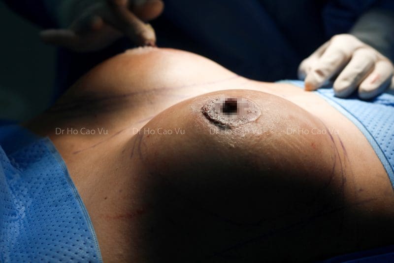 thao-tui-motiva-5
