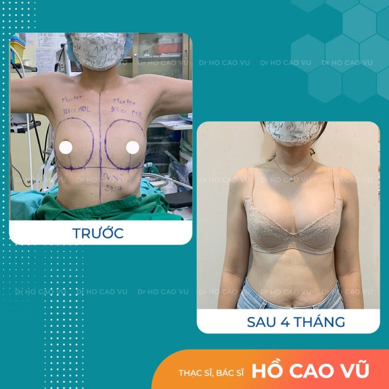 size-nang-nguc-1