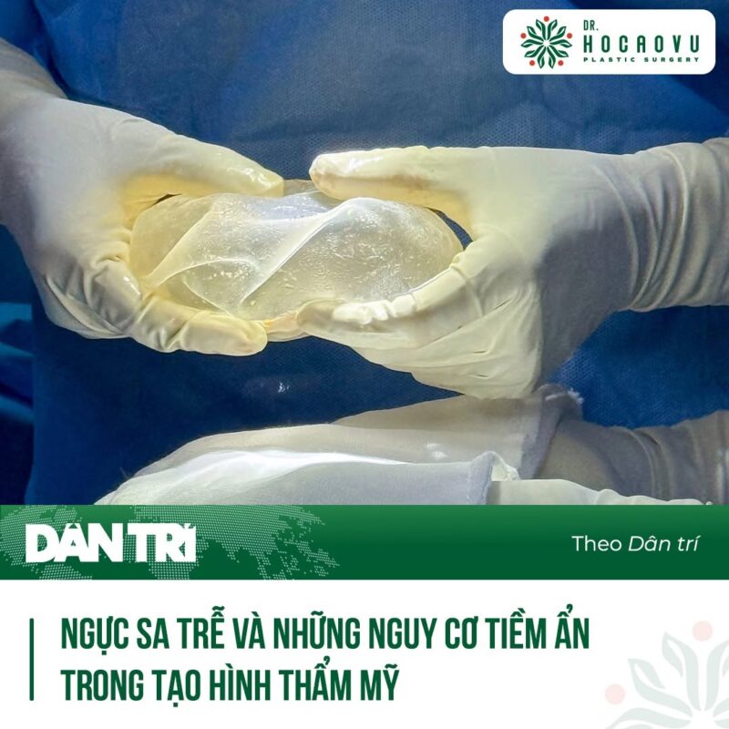 Thẩm