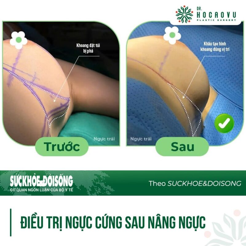 Thẩm