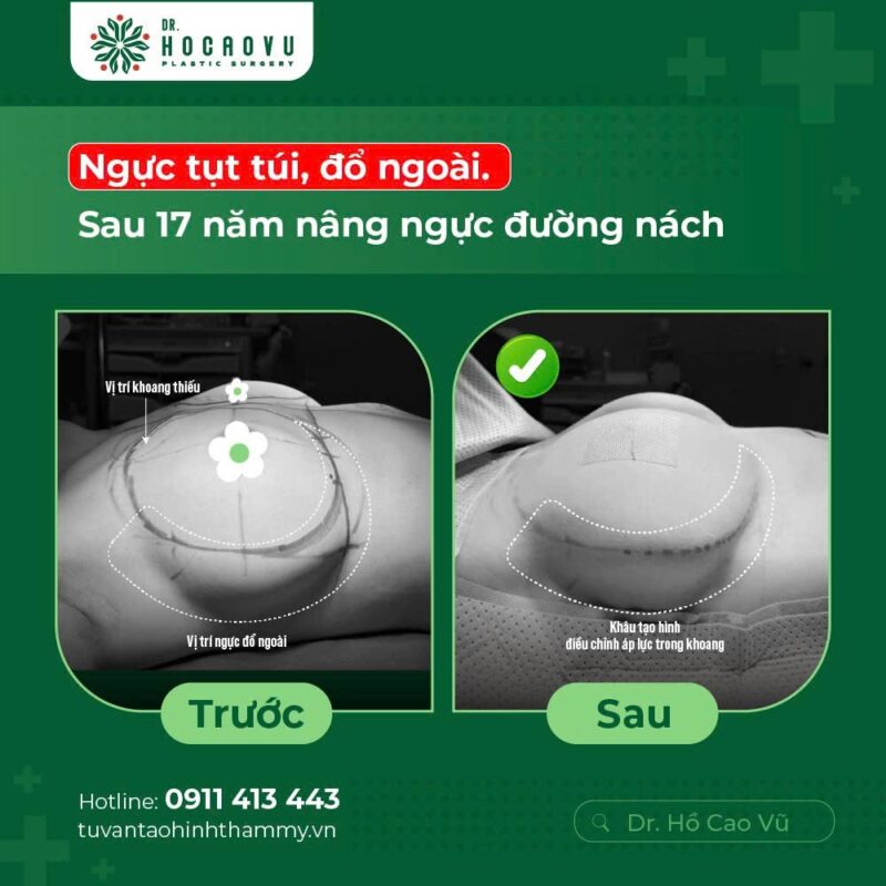 case1
