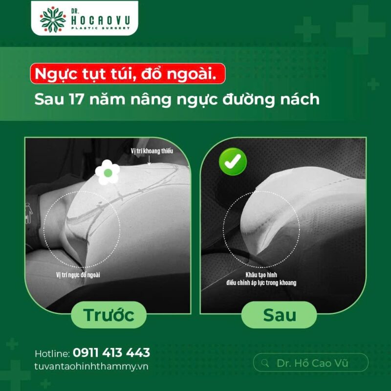 case1