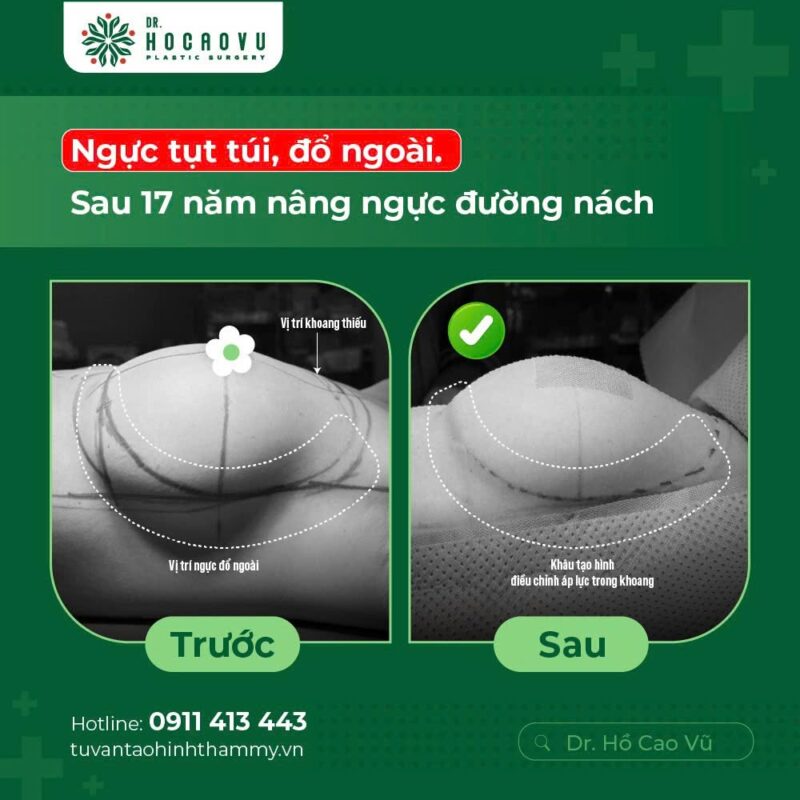 case1