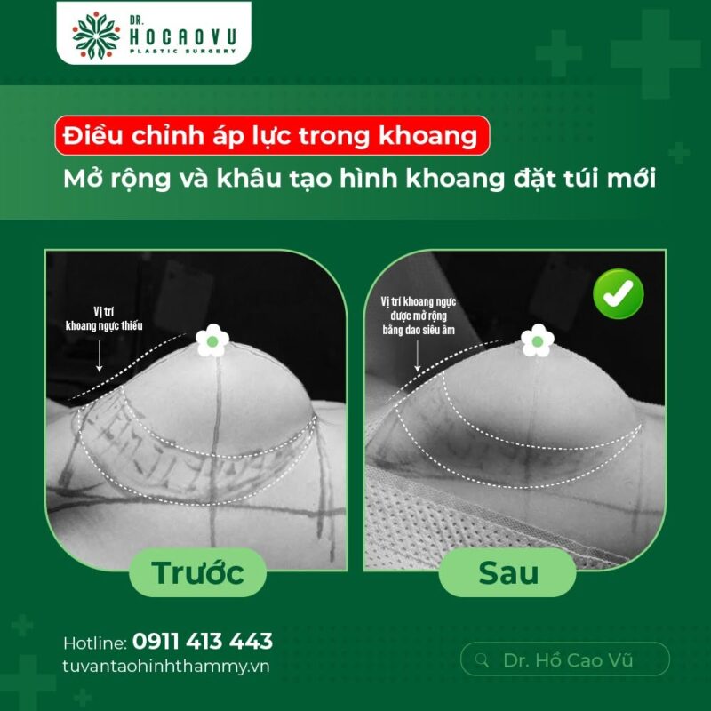 case2