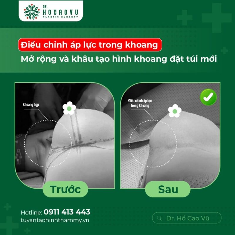 case2