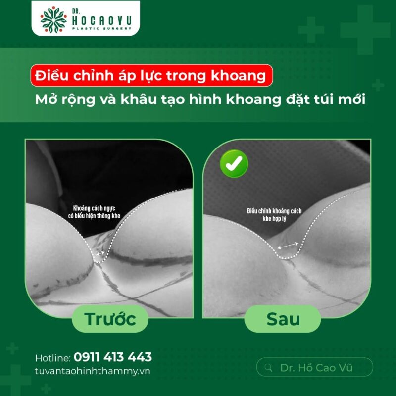 case2