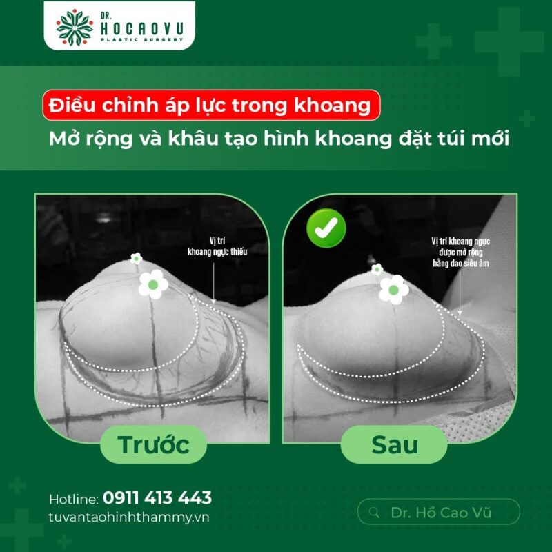 case2