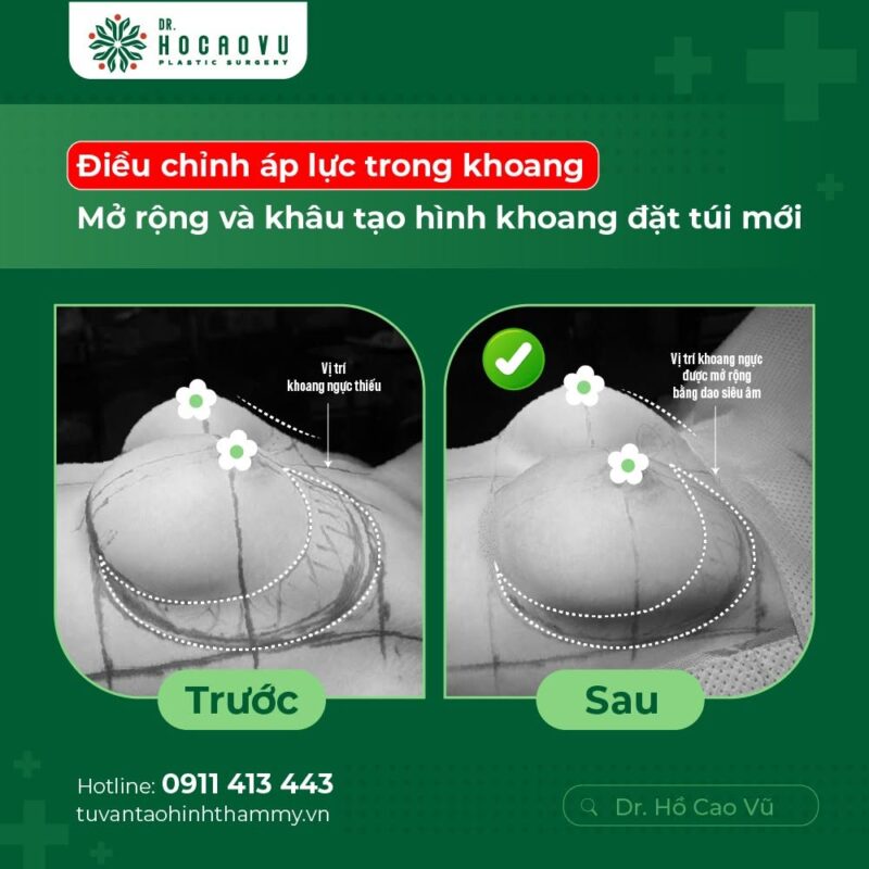 case2