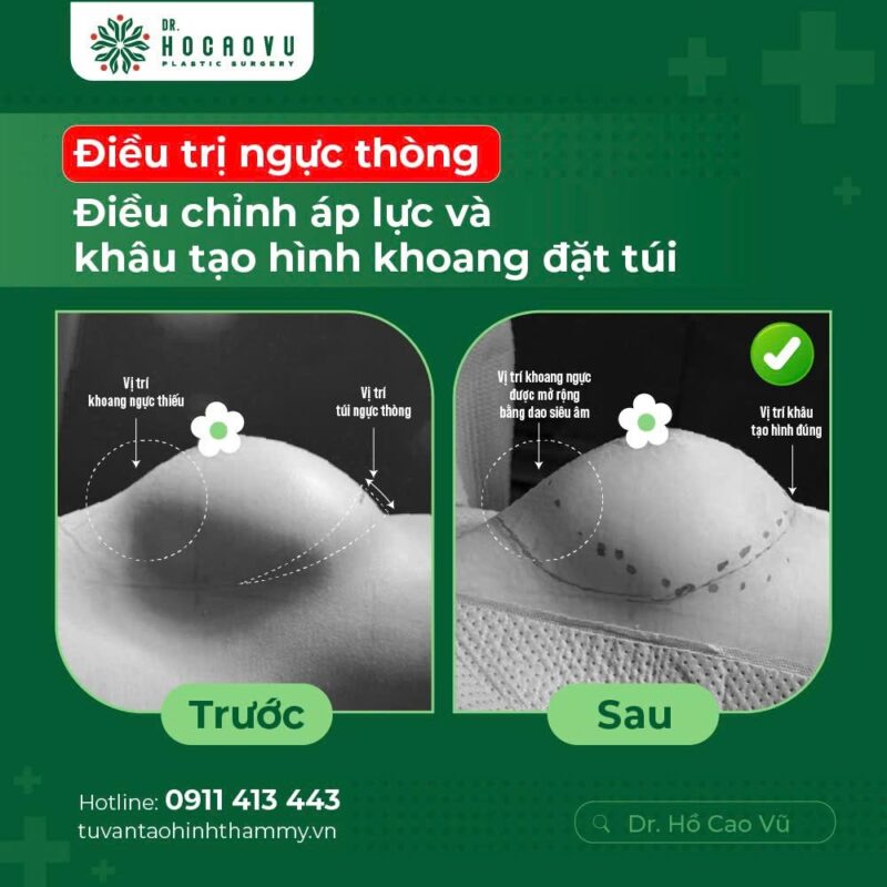 case4