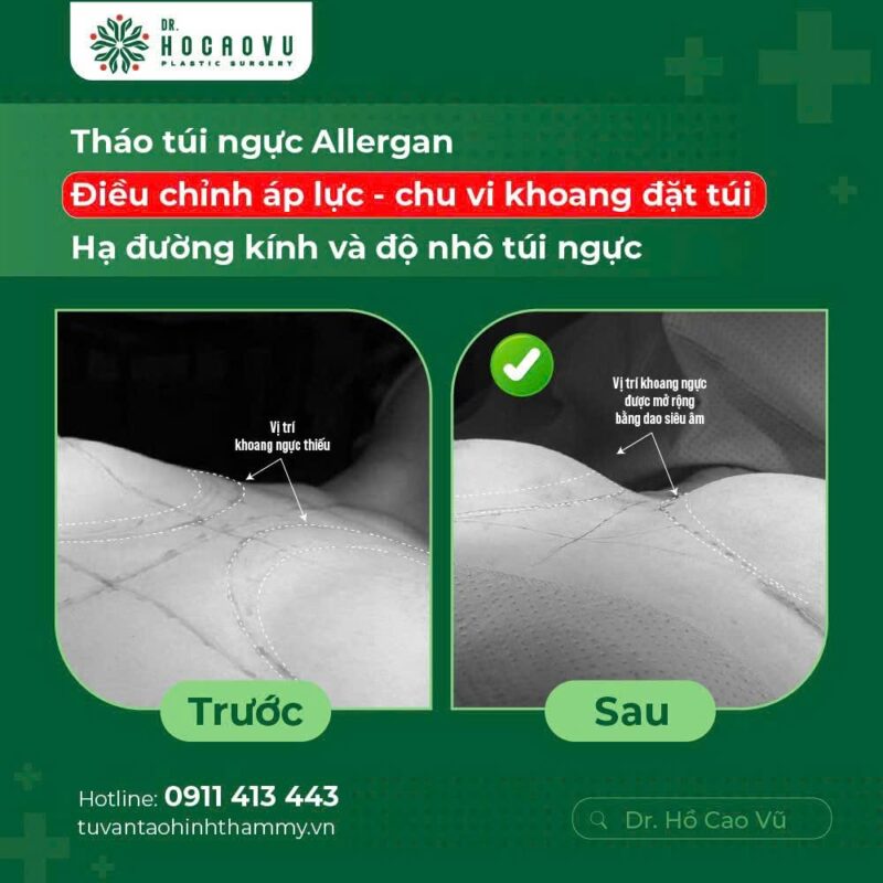 case5