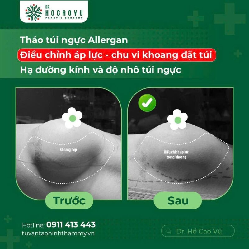 case5