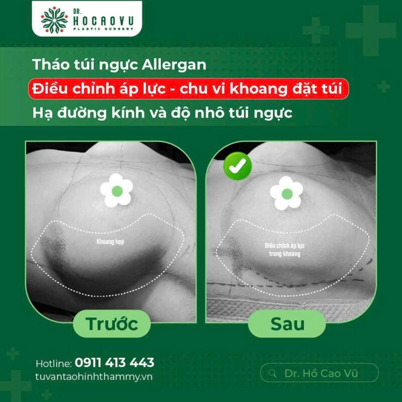 case6