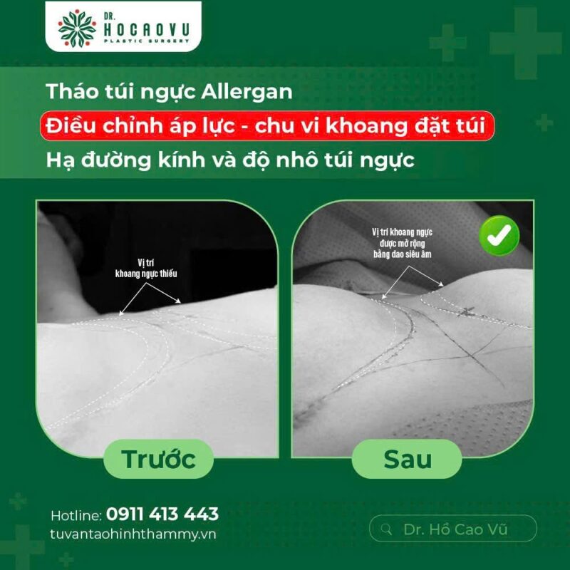 case6