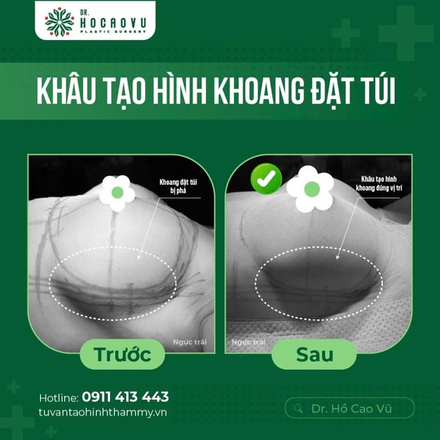chỉnh form