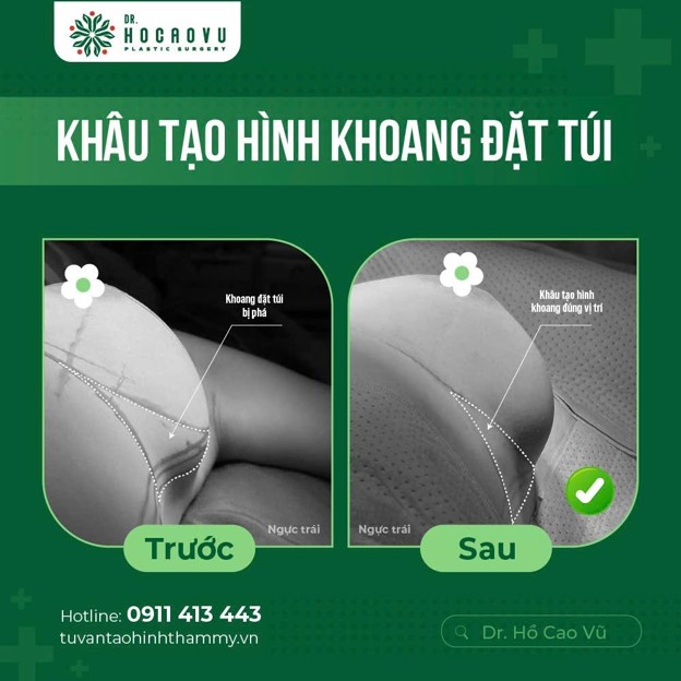 chỉnh form