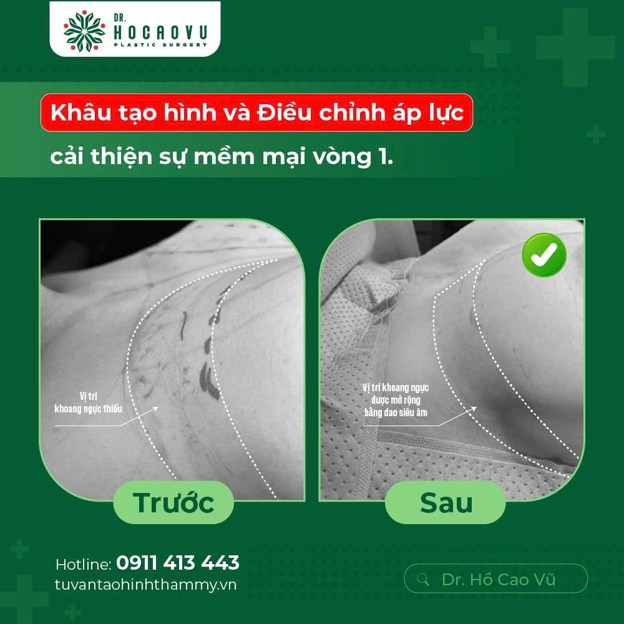 chỉnh form