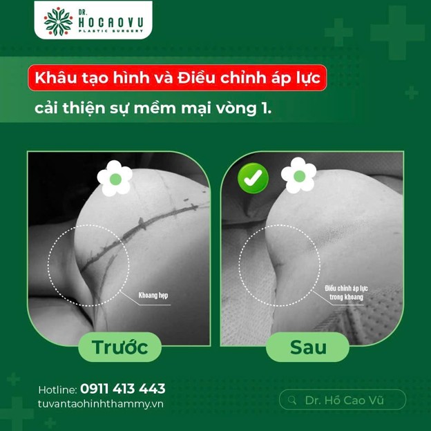 chỉnh form