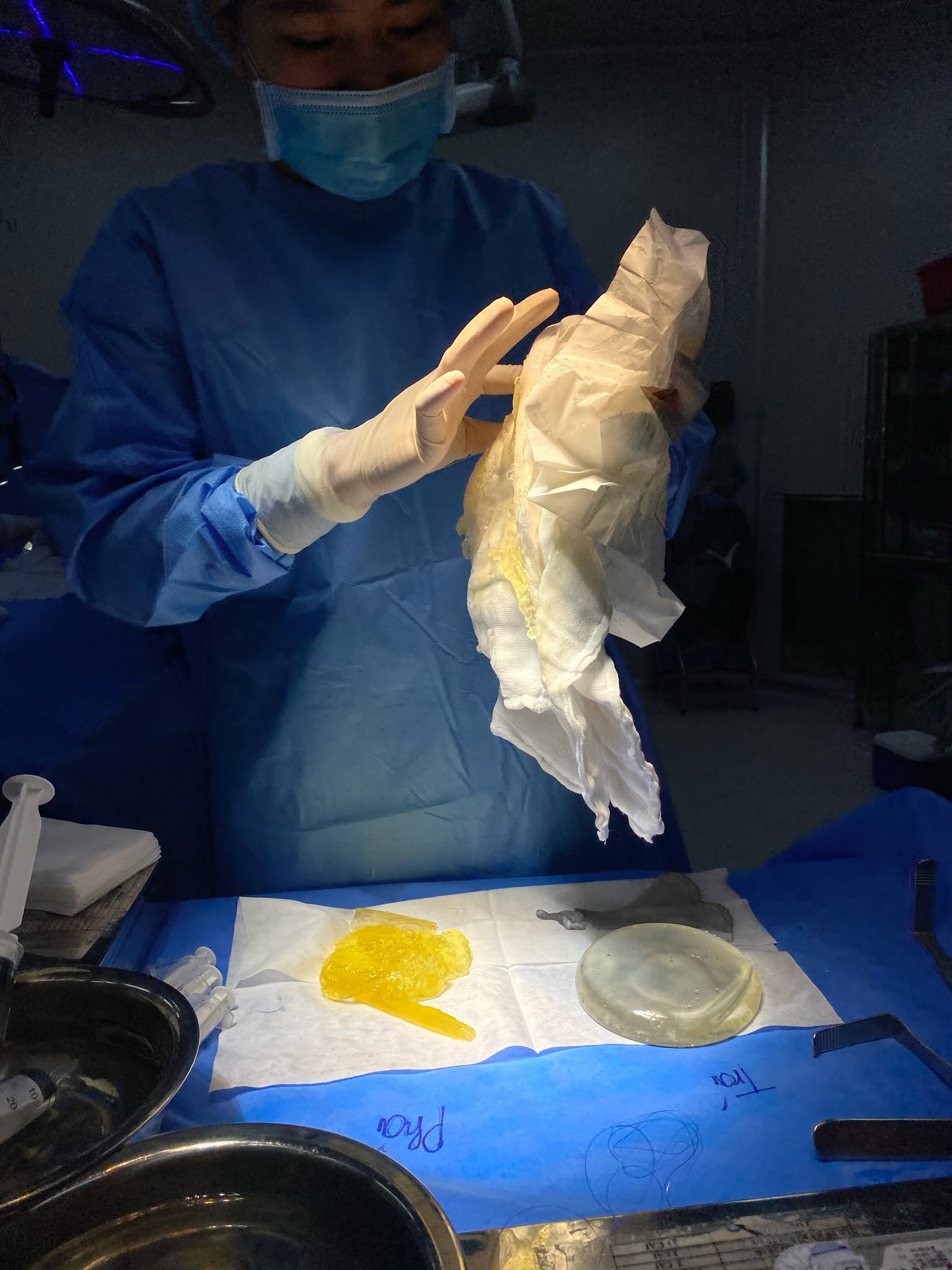 Causes of early breast implant rupture