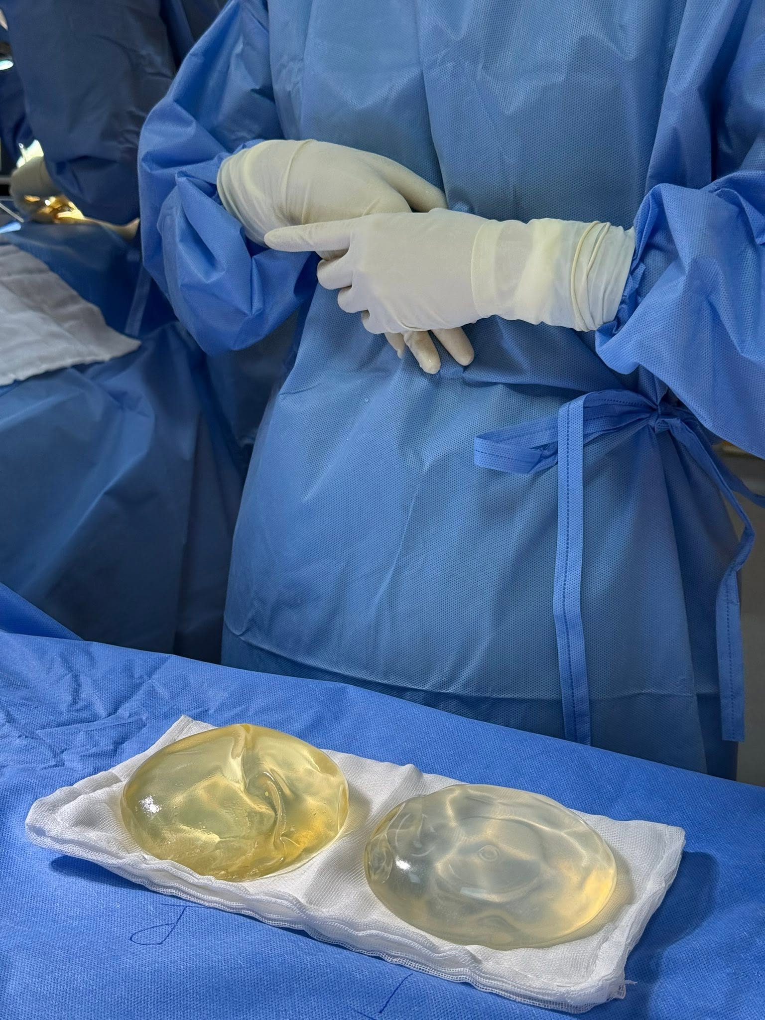 Causes of early breast implant rupture