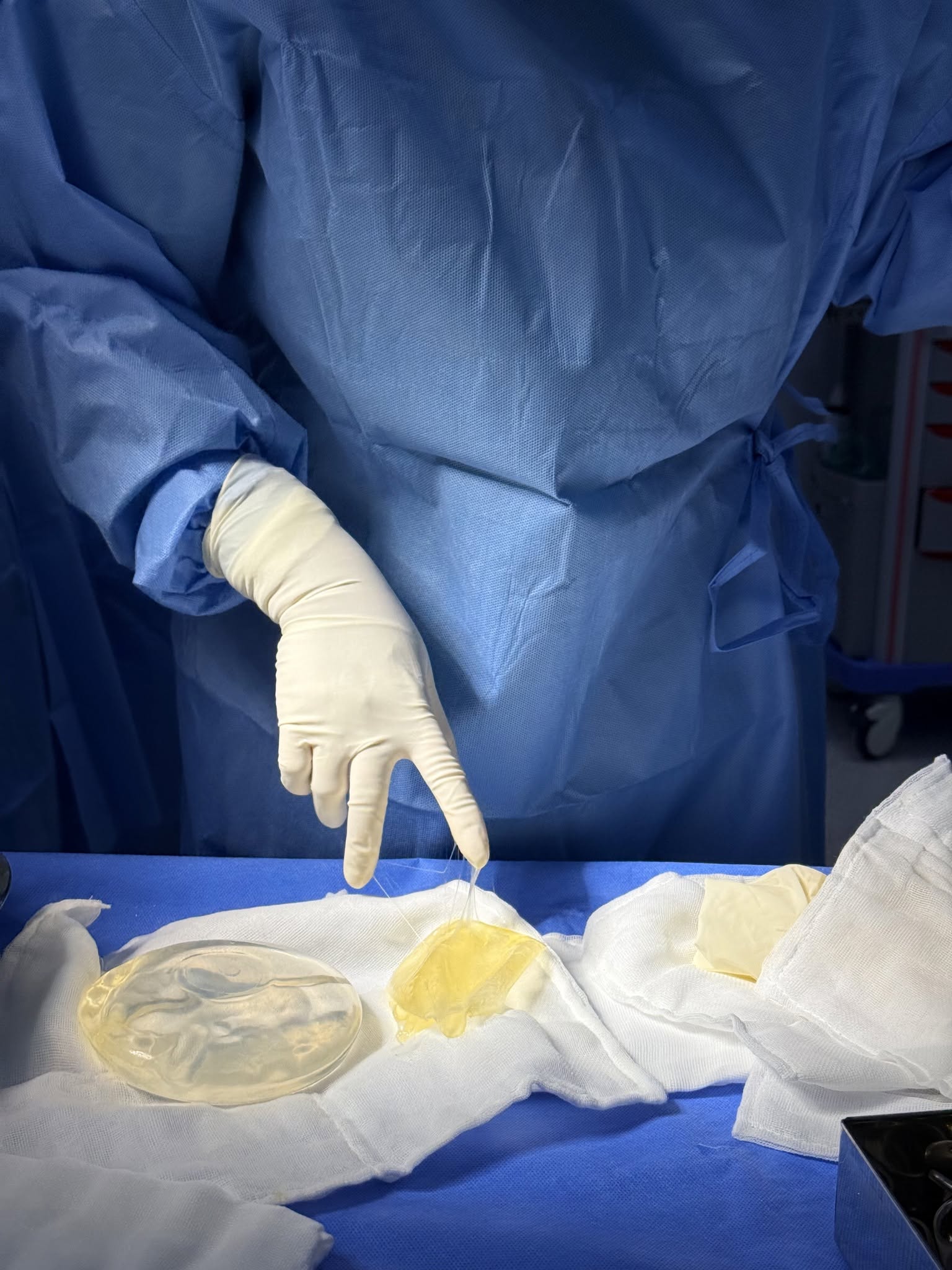 Causes of early breast implant rupture