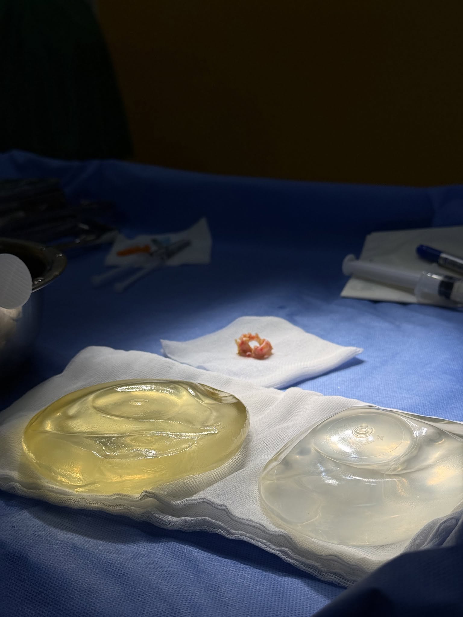 Causes of early breast implant rupture