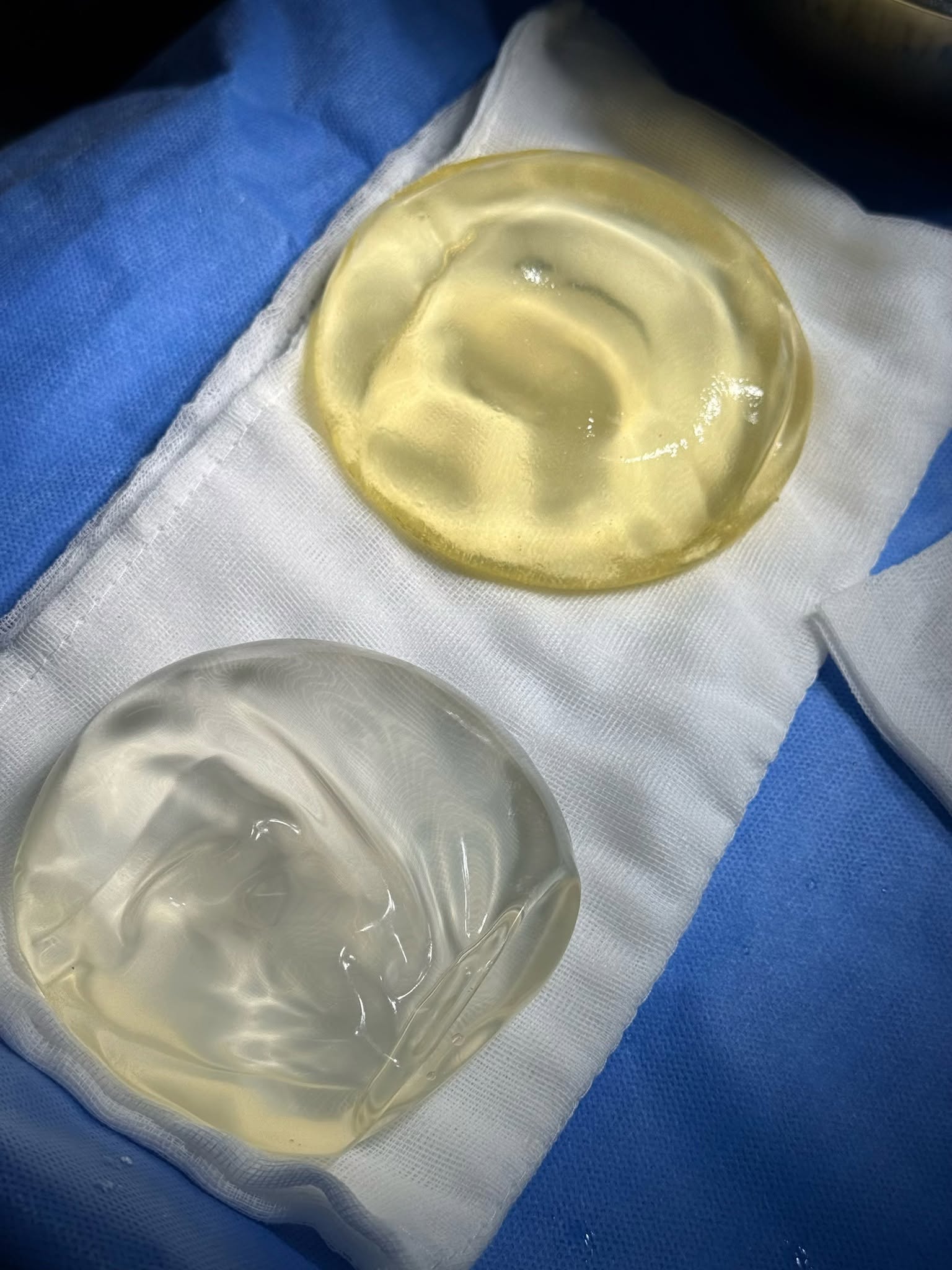 Causes of early breast implant rupture