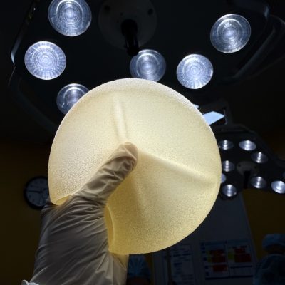 Differences between textured and smooth breast implants on the same body