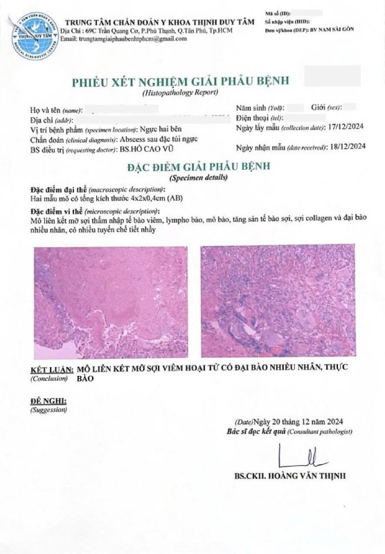 Silent Infection Found During a Third Breast Augmentation: What the Pocket Revealed