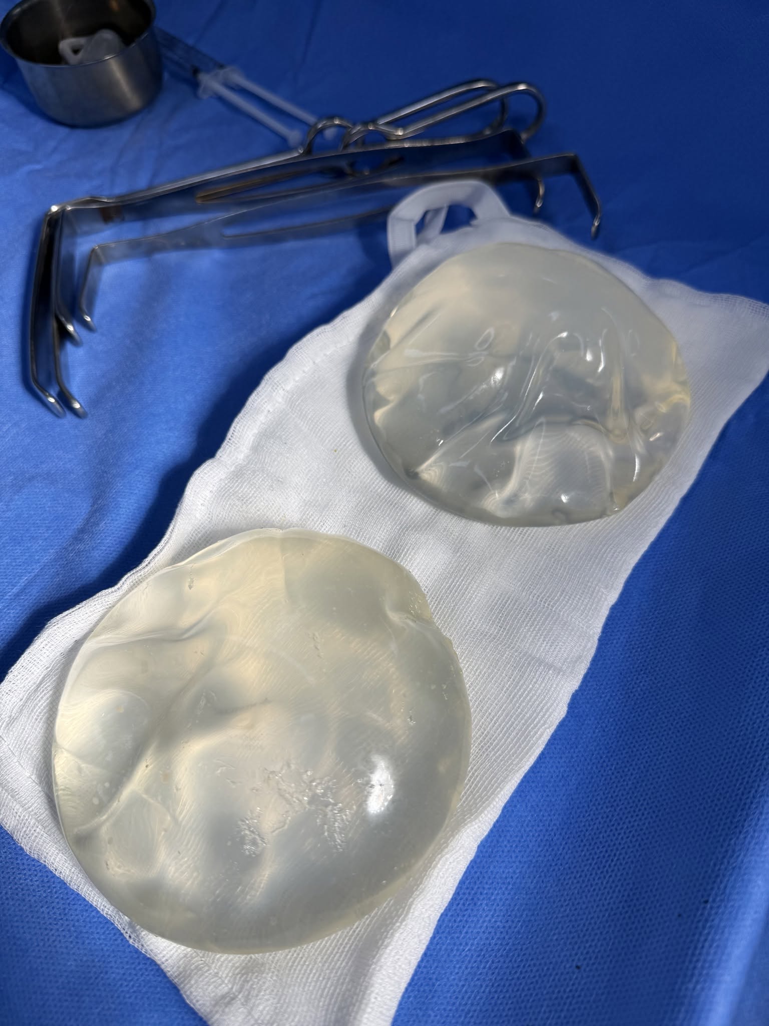 Breast Implant Removal in Vietnam: Cost & Safety Guide