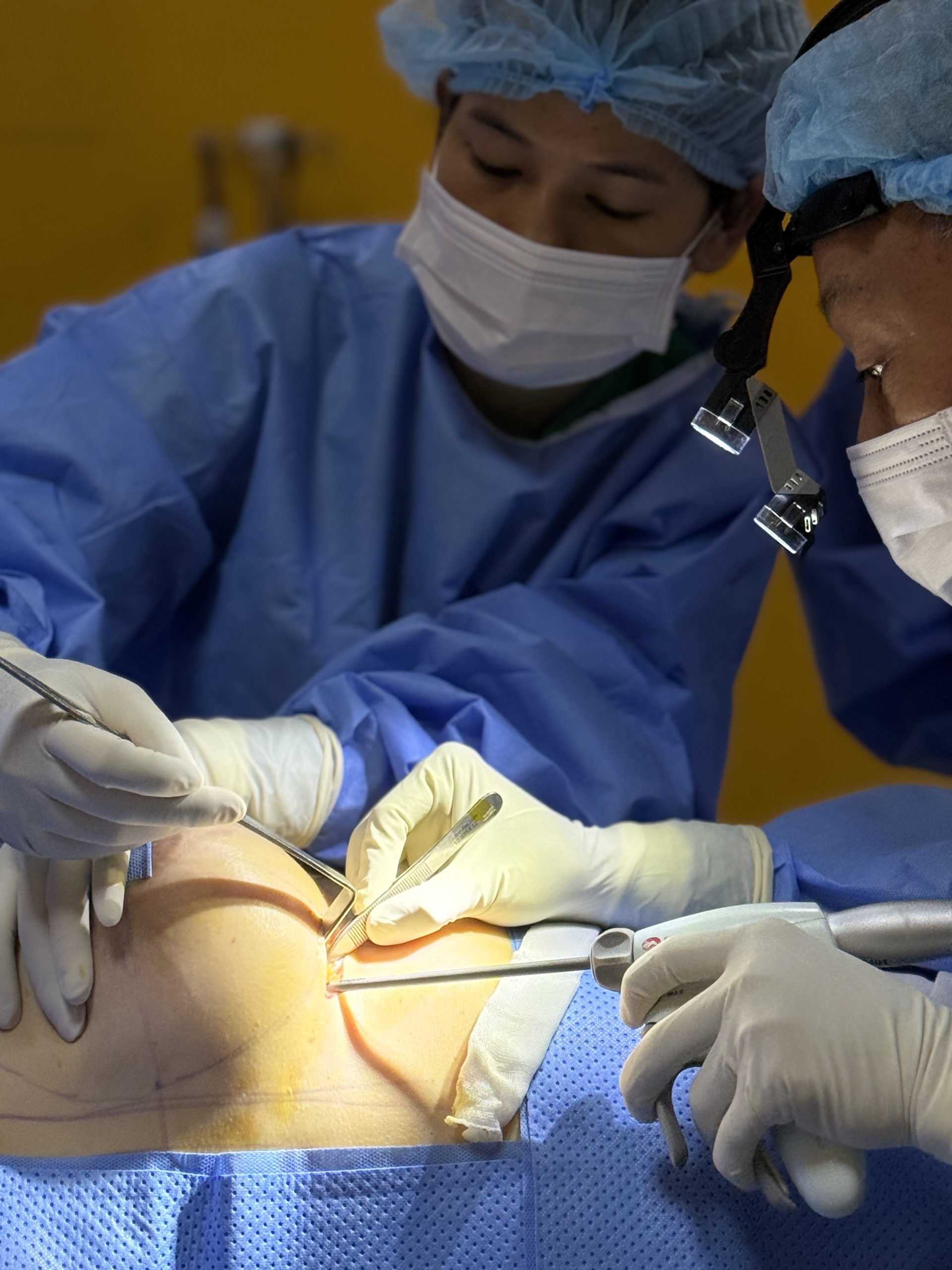 Removal of Polytech Textured Breast Implants After 11 Years - Relief from Grade IV Capsular Contracture