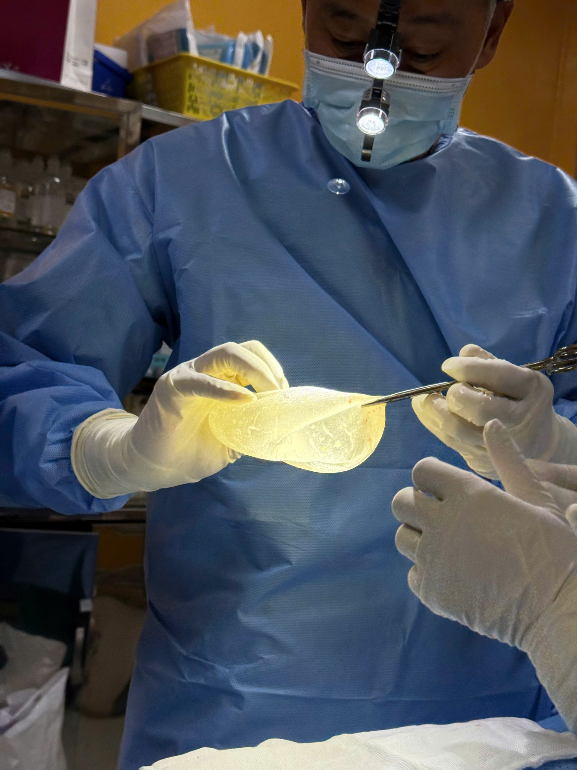 Breast Implant Removal in Vietnam: Cost & Safety Guide