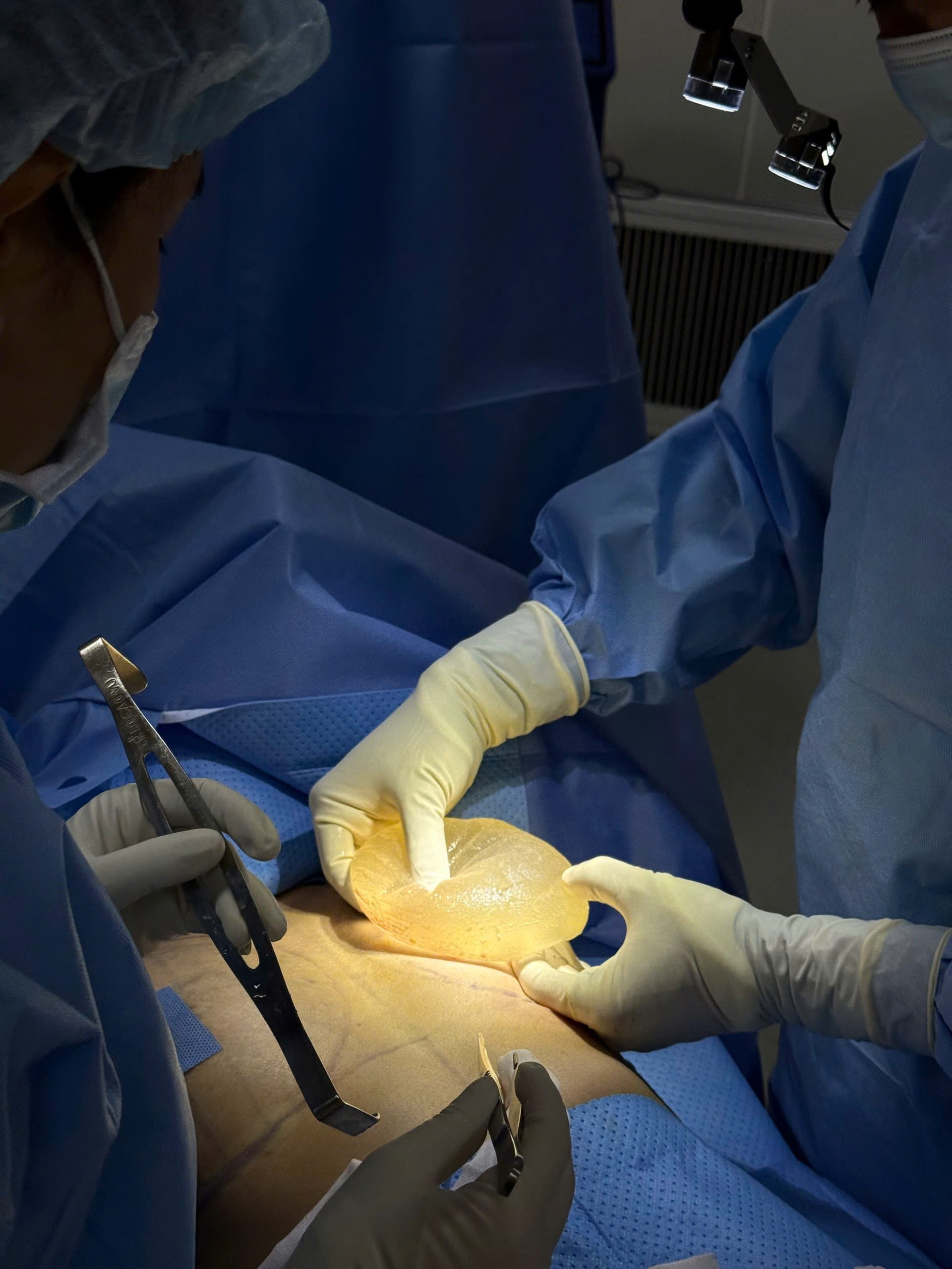 Breast Implant Removal in Vietnam: Cost & Safety Guide