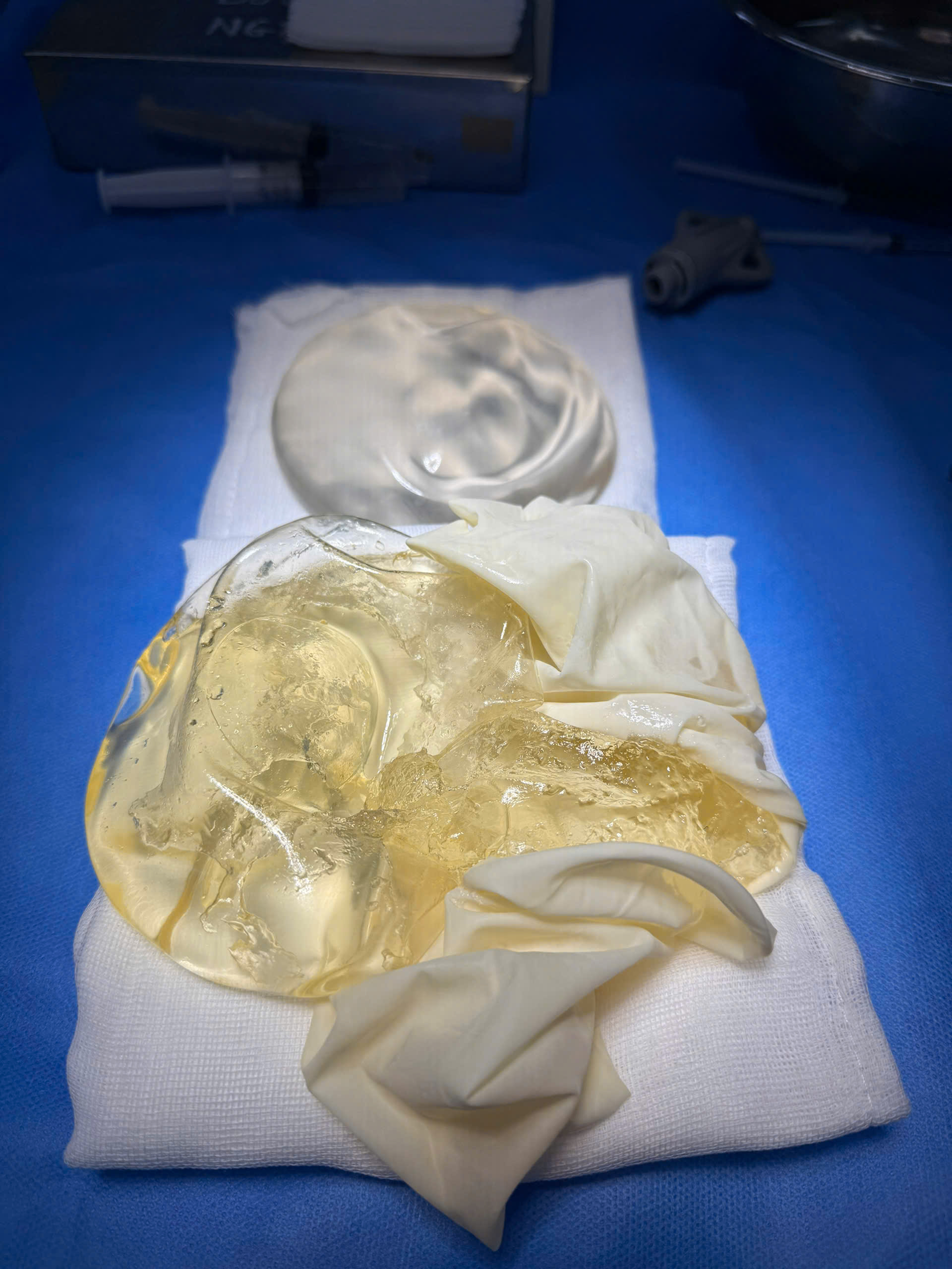 Breast Implant Removal in Vietnam: Cost & Safety Guide